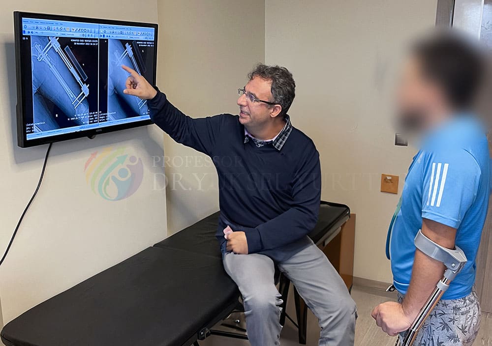 Al paciente discutiendo el progreso de su tratamiento de alargamiento de piernas con el método LON. Las imágenes radiográficas muestran claramente el avance.